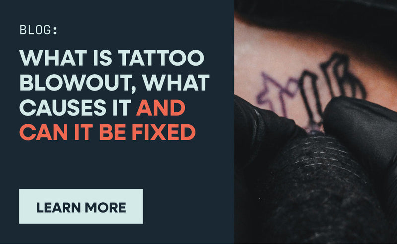 What Is Tattoo Blowout, What Causes It and Can It Be Fixed?