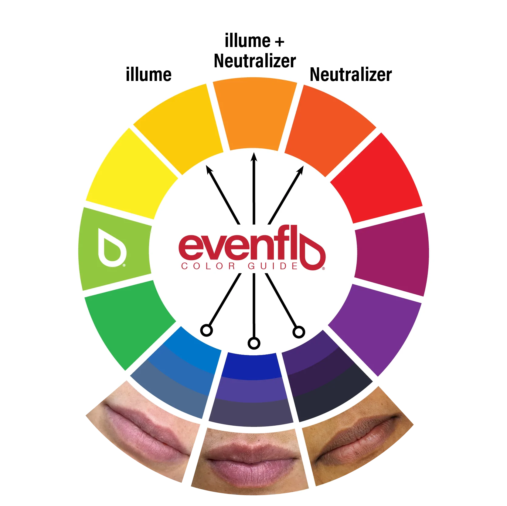 evenflo 1800 number Evenflo Neutralizer Set — 3 1/2oz Bottles